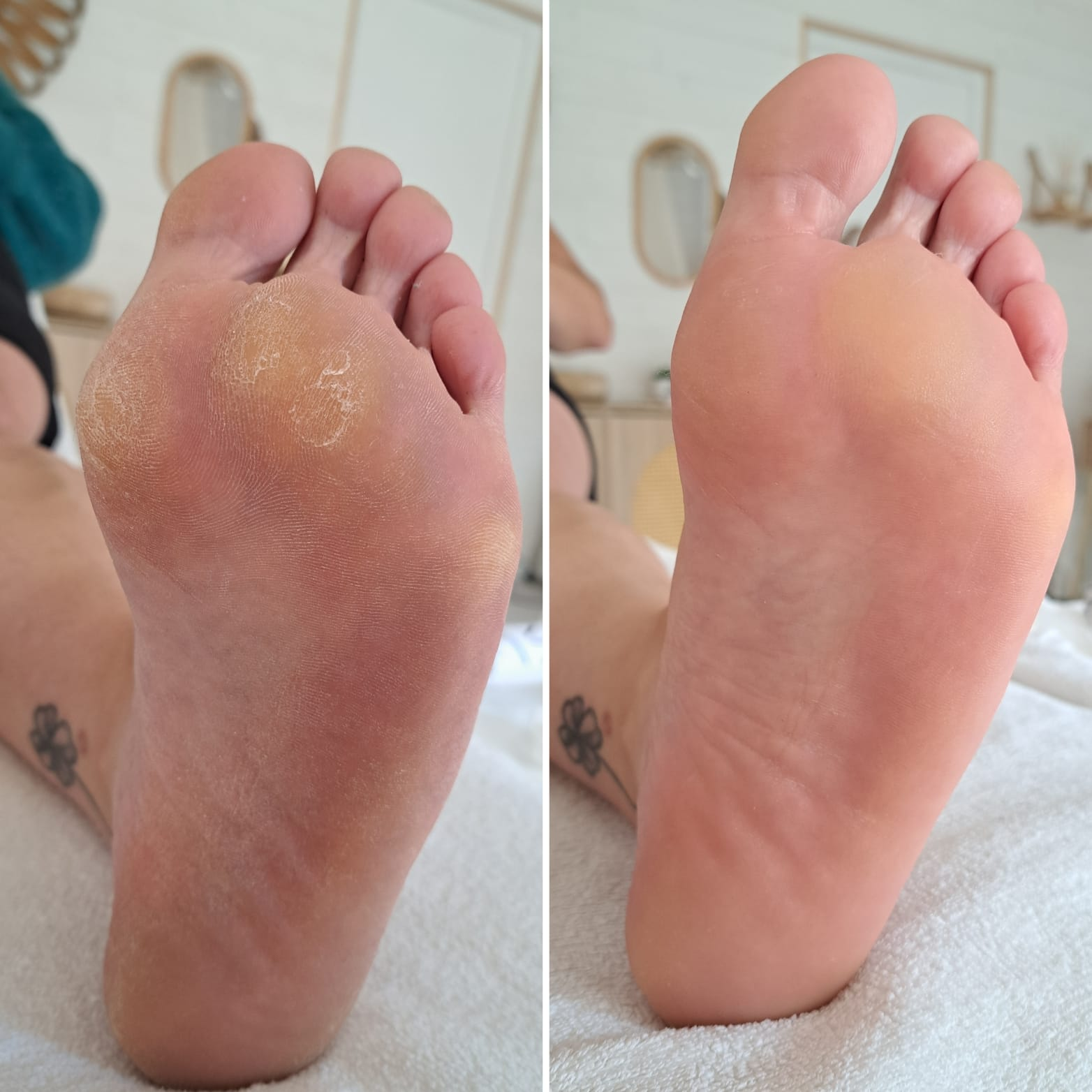 Avant et après un soin Yumi Feet